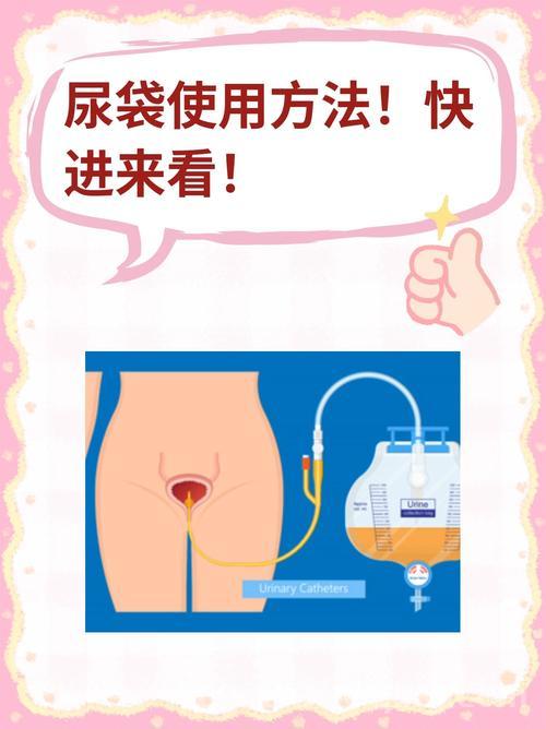 尿袋双雄怎么选？这几个方面要注意！