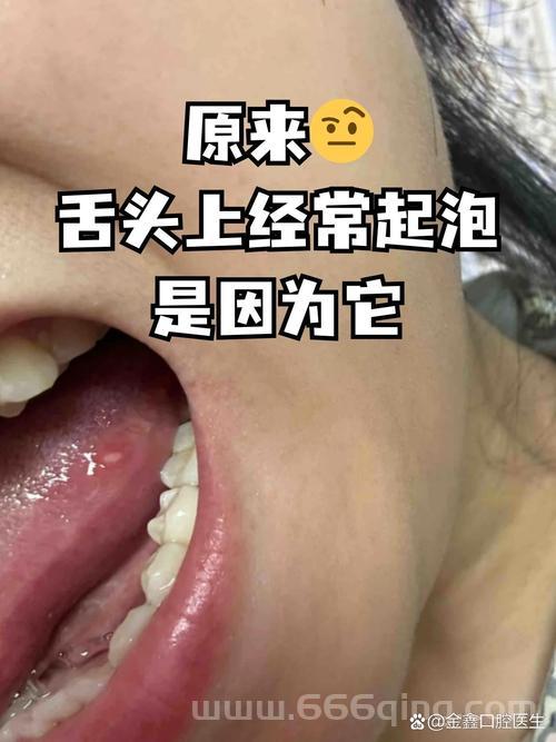 妹纸认证老是过不了？多半是这几个原因没注意到！